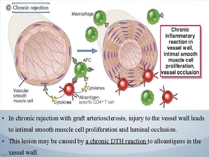  • In chronic rejection with graft arteriosclerosis, injury to the vessel wall leads
