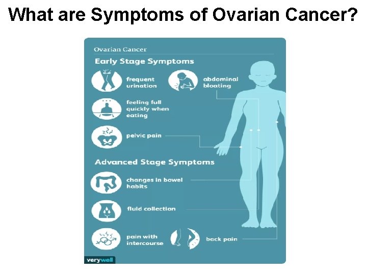 What are Symptoms of Ovarian Cancer? 