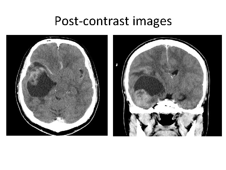 Post-contrast images 