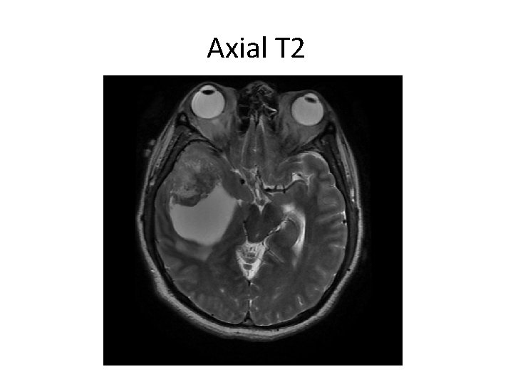 Axial T 2 