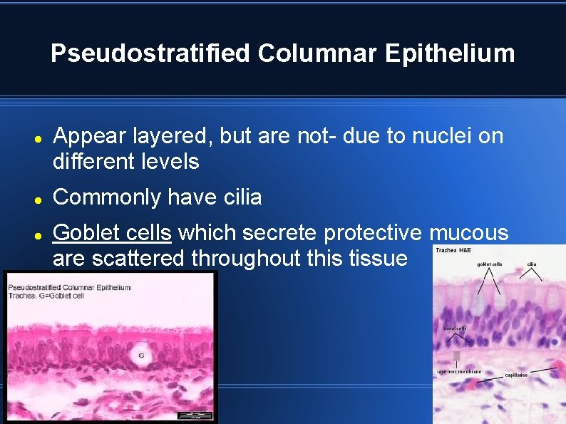 Pseudostratified Columnar Epithelium Appear layered, but are not- due to nuclei on different levels Pseudostratified Columnar Epithelium Appear layered, but are not- due to nuclei on different levels