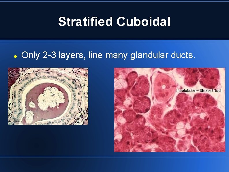 Stratified Cuboidal Only 2 -3 layers, line many glandular ducts. Stratified Cuboidal Only 2 -3 layers, line many glandular ducts.