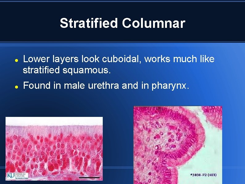 Stratified Columnar Lower layers look cuboidal, works much like stratified squamous. Found in male Stratified Columnar Lower layers look cuboidal, works much like stratified squamous. Found in male