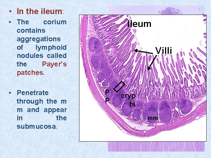  • In the ileum: • The corium contains aggregations of lymphoid nodules called