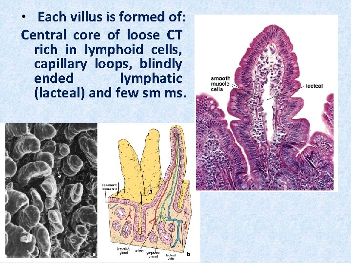  • Each villus is formed of: Central core of loose CT rich in