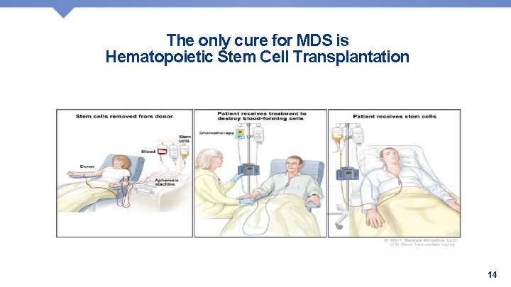 The only cure for MDS is Hematopoietic Stem Cell Transplantation Affiliated with • Affilié