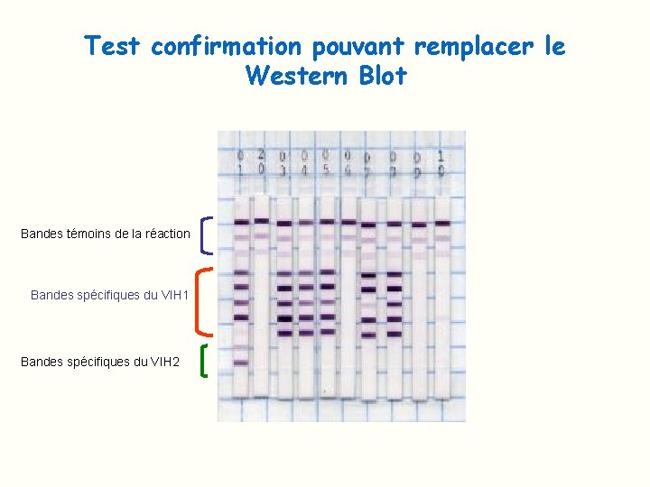 Test confirmation pouvant remplacer le Western Blot Bandes témoins de la réaction Bandes spécifiques