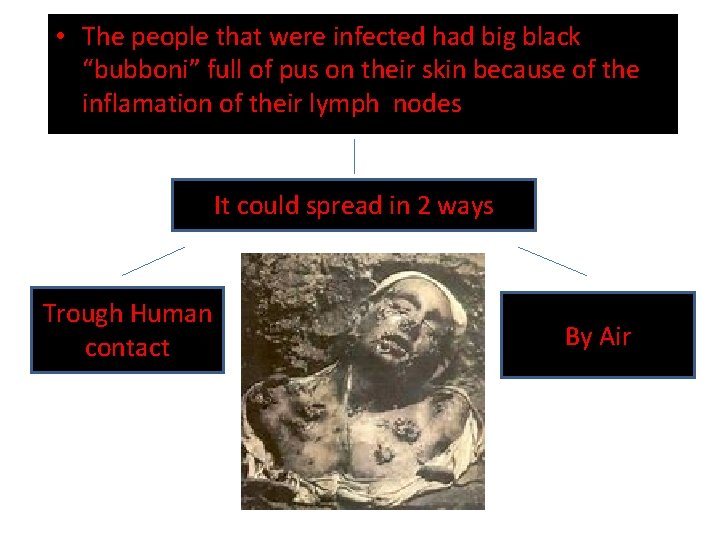  • The people that were infected had big black “bubboni” full of pus