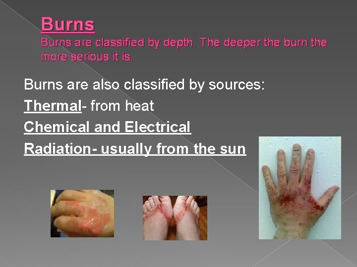 Burns are classified by depth. The deeper the burn the more serious it is.