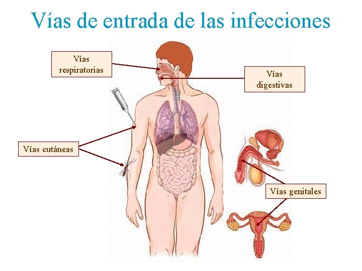 Vías de entrada de las infecciones Vías respiratorias Vías digestivas Vías cutáneas Vías genitales