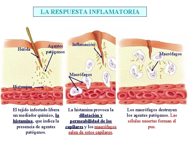 LA RESPUESTA INFLAMATORIA Herida Agentes patógenos Inflamación Macrófagos Histamina El tejido infectado libera un