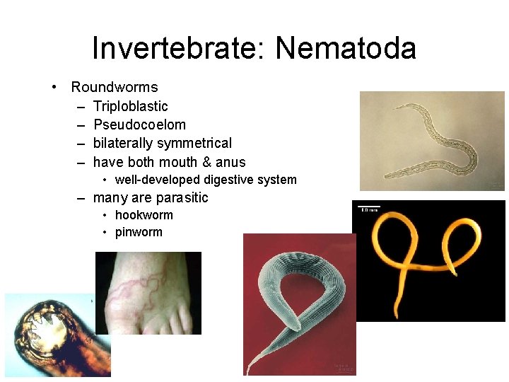 Invertebrate: Nematoda • Roundworms – Triploblastic – Pseudocoelom – bilaterally symmetrical – have both