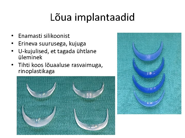 Lõua implantaadid • Enamasti silikoonist • Erineva suurusega, kujuga • U-kujulised, et tagada ühtlane