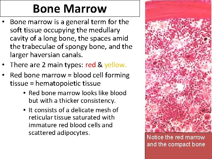 Bone Marrow • Bone marrow is a general term for the soft tissue occupying