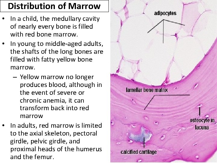 Distribution of Marrow • In a child, the medullary cavity of nearly every bone