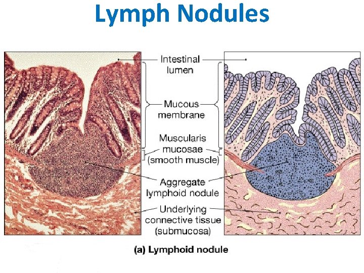 Lymph Nodules 