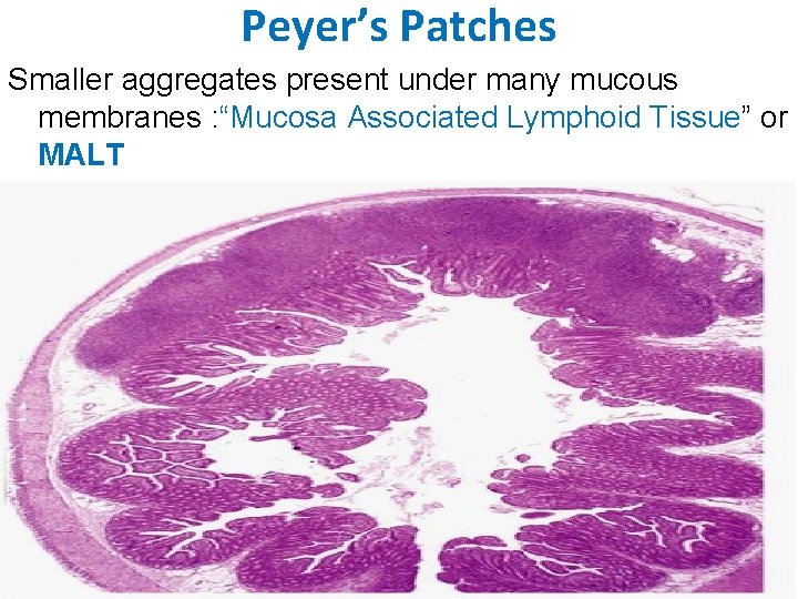 Peyer’s Patches Smaller aggregates present under many mucous membranes : “Mucosa Associated Lymphoid Tissue”