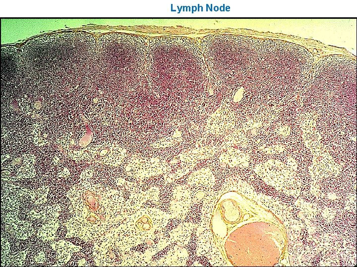 Lymph Node 