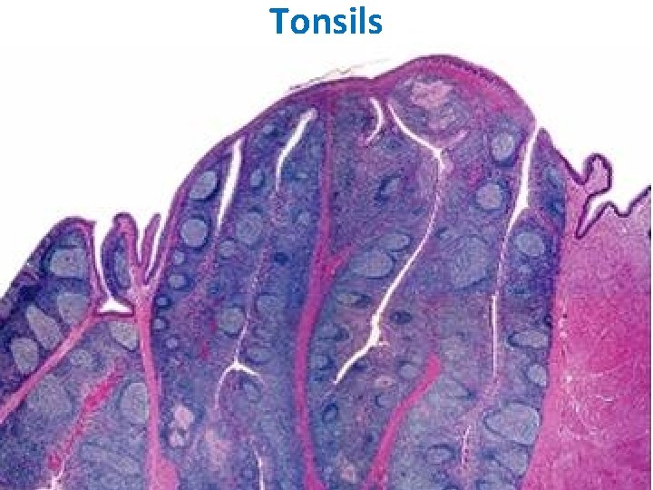 Tonsils 