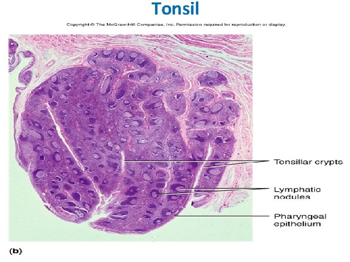 Tonsil 