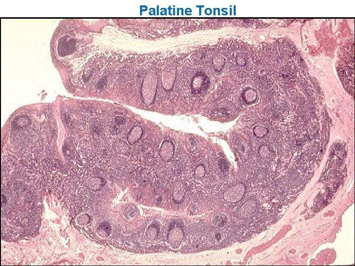 Palatine Tonsil 