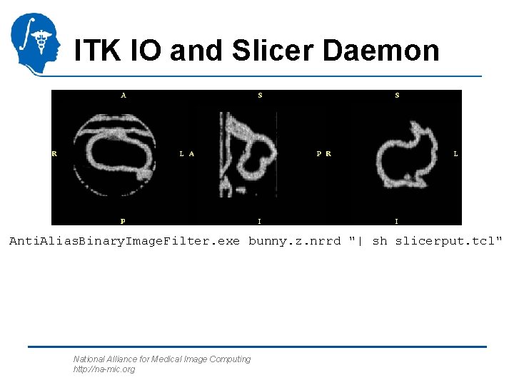 ITK IO and Slicer Daemon Anti. Alias. Binary. Image. Filter. exe bunny. z. nrrd