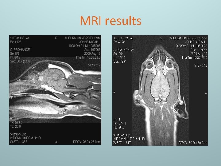 MRI results 