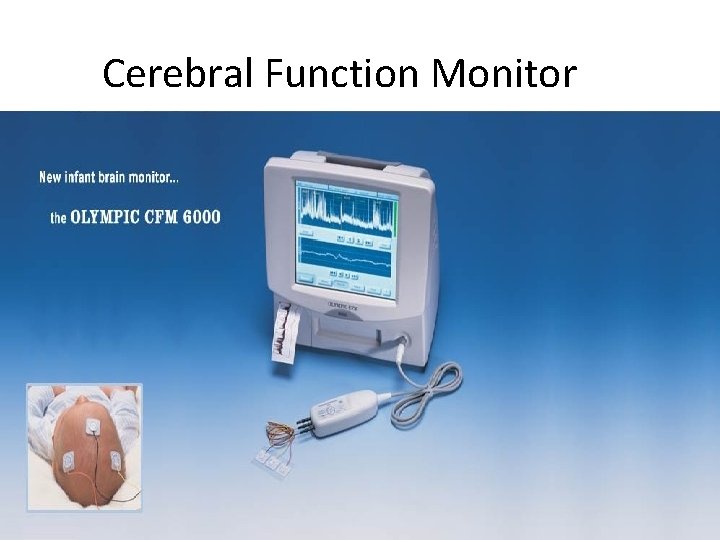 Cerebral Function Monitor 
