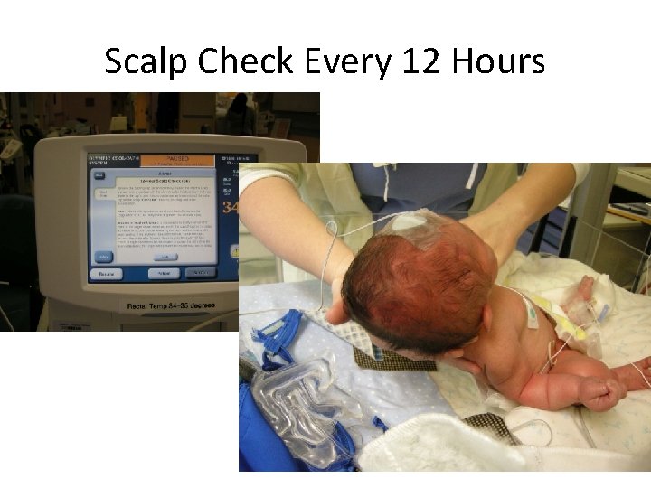 Scalp Check Every 12 Hours 