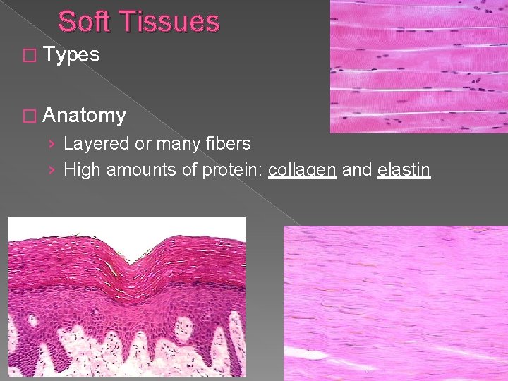 Soft Tissues � Types � Anatomy › Layered or many fibers › High amounts