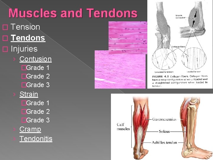 Muscles and Tendons Tension � Tendons � Injuries � › Contusion �Grade 1 �Grade