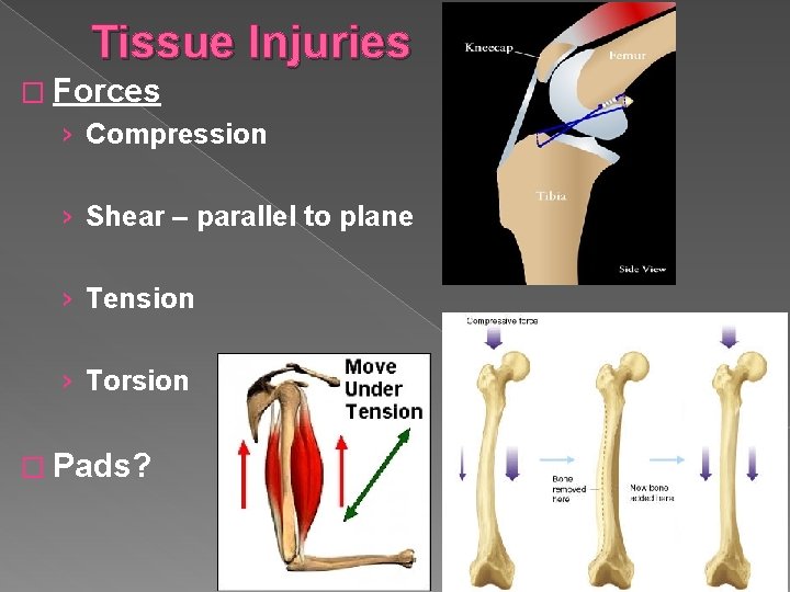 Tissue Injuries � Forces › Compression › Shear – parallel to plane › Tension