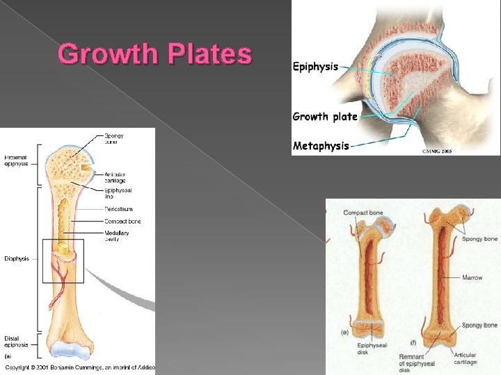 Growth Plates 