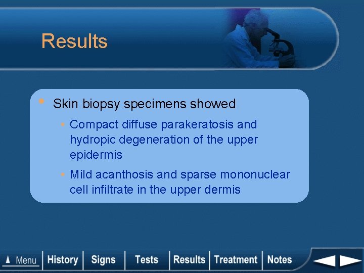 Results • Skin biopsy specimens showed • Compact diffuse parakeratosis and hydropic degeneration of