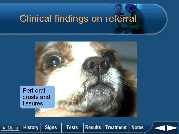 Clinical findings on referral Peri-oral crusts and fissures 