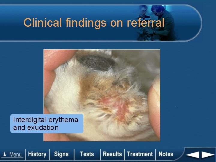 Clinical findings on referral Interdigital erythema and exudation 