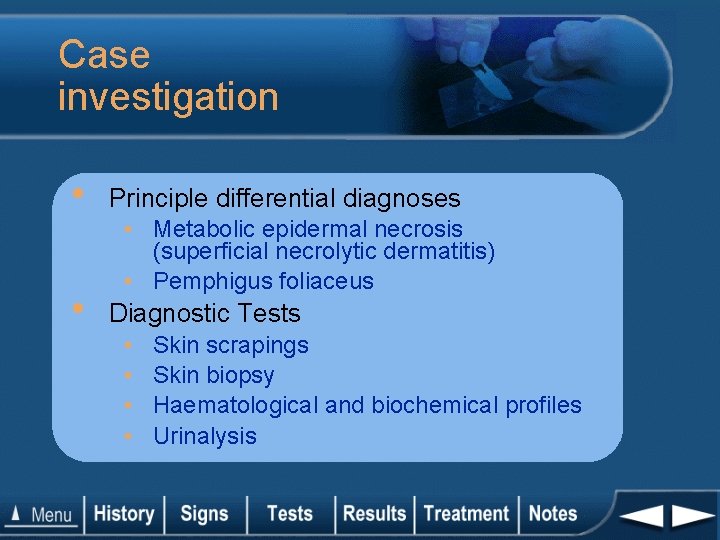 Case investigation • • Principle differential diagnoses • Metabolic epidermal necrosis (superficial necrolytic dermatitis)