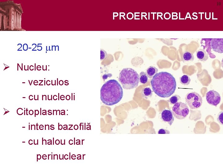 10 PROERITROBLASTUL 20 -25 mm Ø Nucleu: - veziculos - cu nucleoli Ø Citoplasma: