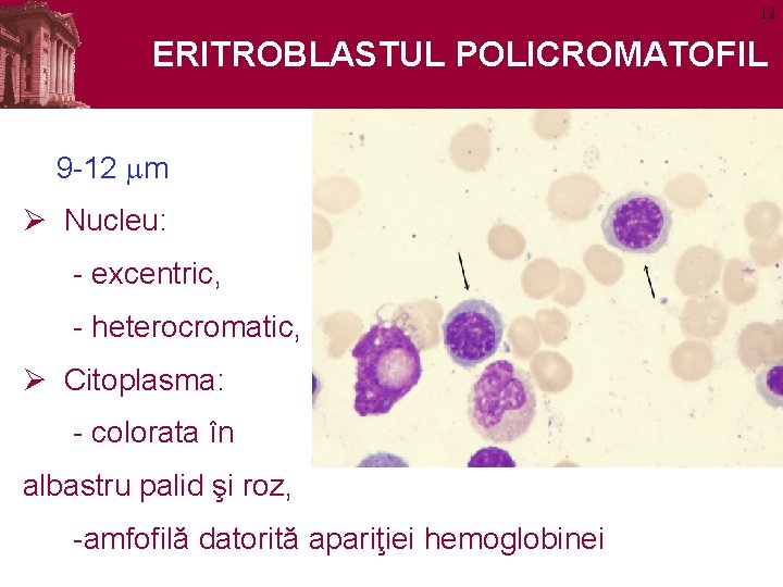 12 ERITROBLASTUL POLICROMATOFIL 9 -12 mm Ø Nucleu: - excentric, - heterocromatic, Ø Citoplasma: