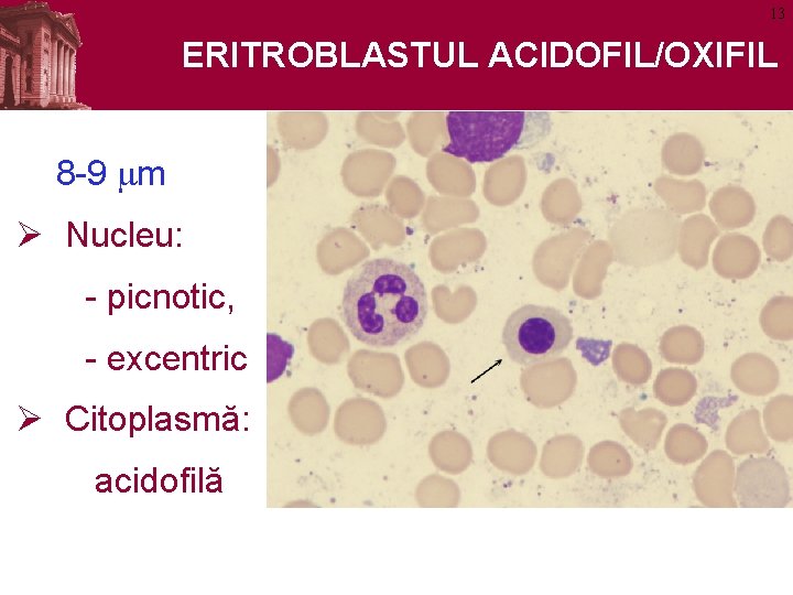 13 ERITROBLASTUL ACIDOFIL/OXIFIL 8 -9 mm Ø Nucleu: - picnotic, - excentric Ø Citoplasmă: