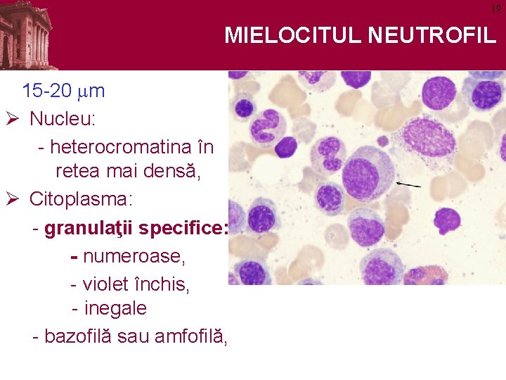 19 MIELOCITUL NEUTROFIL 15 -20 mm Ø Nucleu: - heterocromatina în retea mai densă,