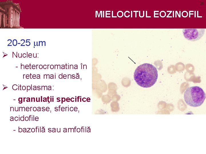 20 MIELOCITUL EOZINOFIL 20 -25 mm Ø Nucleu: - heterocromatina în retea mai densă,