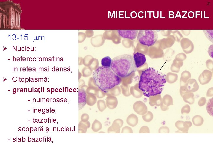 21 MIELOCITUL BAZOFIL 13 -15 mm Ø Nucleu: - heterocromatina în retea mai densă,