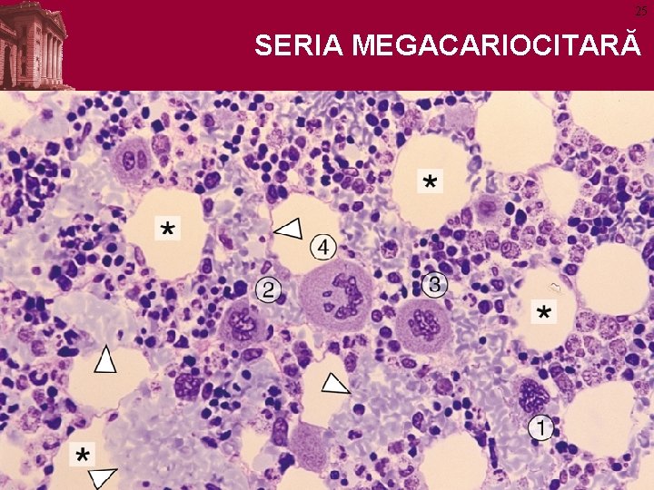 25 SERIA MEGACARIOCITARĂ 