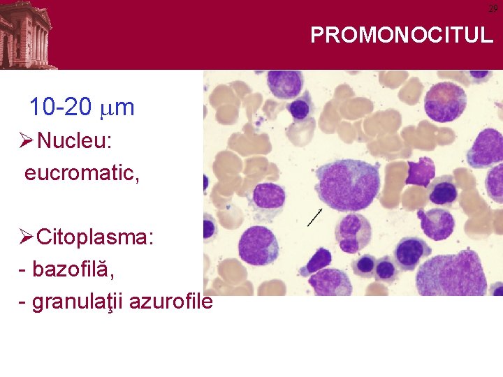 29 PROMONOCITUL 10 -20 mm ØNucleu: eucromatic, ØCitoplasma: - bazofilă, - granulaţii azurofile 