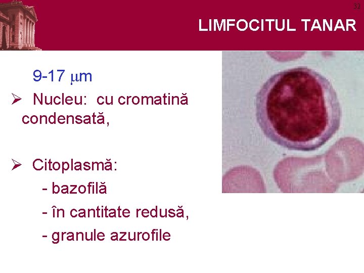 32 LIMFOCITUL TANAR 9 -17 mm Ø Nucleu: cu cromatină condensată, Ø Citoplasmă: -