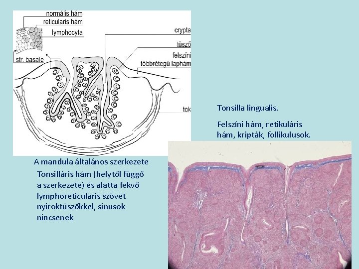 Tonsilla lingualis. Felszíni hám, retikuláris hám, kripták, follikulusok. A mandula általános szerkezete Tonsilláris hám