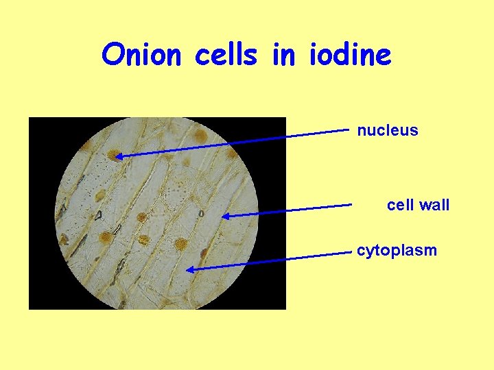 Onion cells in iodine nucleus cell wall cytoplasm 
