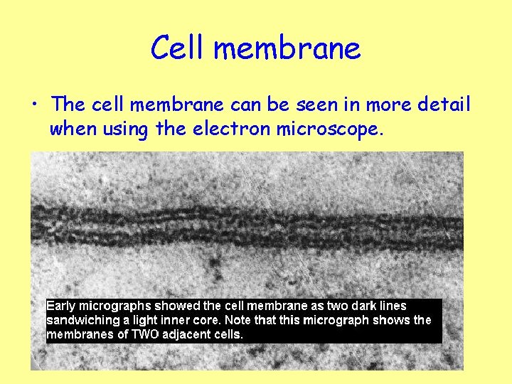Cell membrane • The cell membrane can be seen in more detail when using
