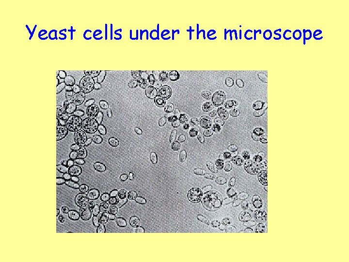 Yeast cells under the microscope 